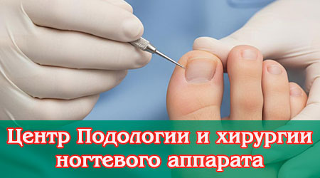 Центр подологии и хирургии ногтевого аппарата